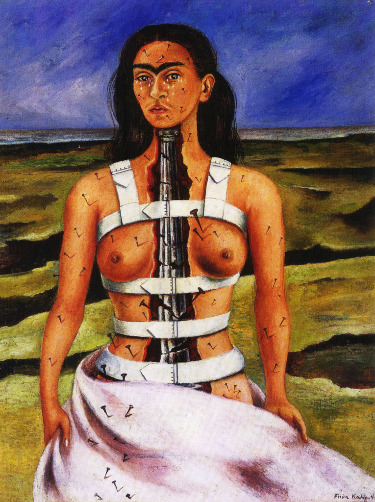 Frida, "The Broken Column"